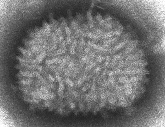 Vaccinia virus
